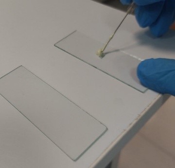 پر کننده کانال ریشه دندان چیست؟ m/پر کننده کانال ریشه دندان چیست؟