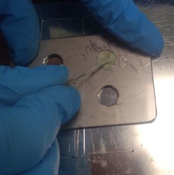 پر کننده کانال ریشه دندان چیست؟ m/پر کننده کانال ریشه دندان چیست؟